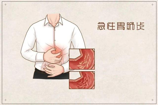 急性肠胃炎 (1).jpeg