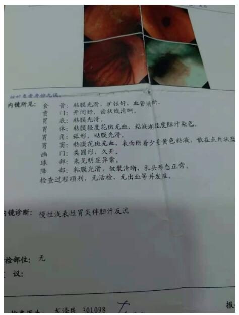 浅表性胃炎报告.JPEG