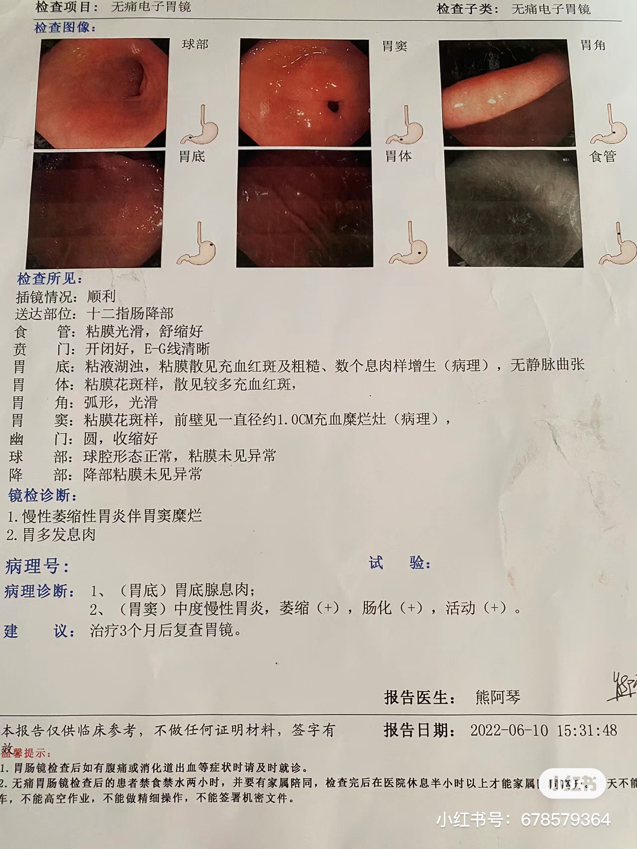 1700733570212123.jpg