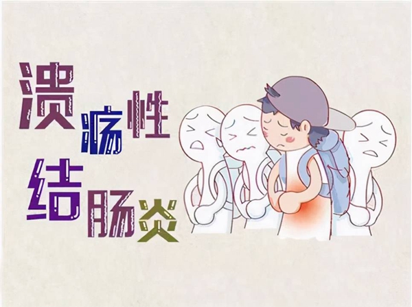 溃疡结肠炎.jpeg
