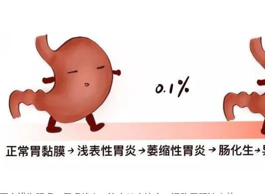 慢性胃炎.jpg