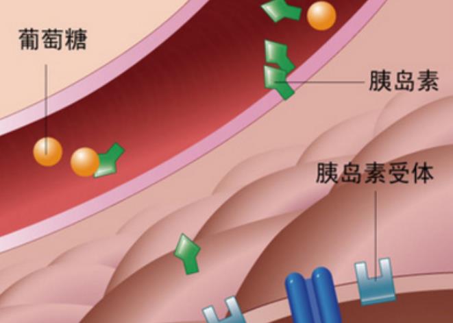 2型糖尿病.jpg