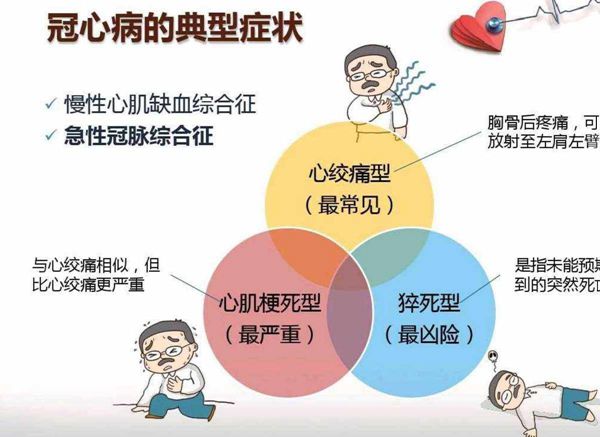 冠心病症状.jpeg