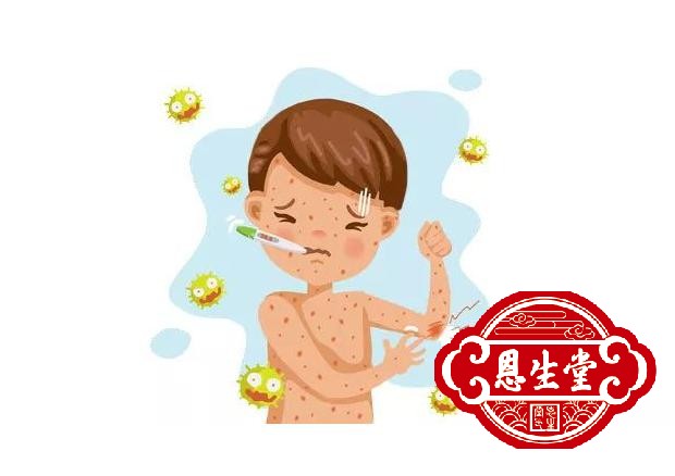 慢性荨麻疹 (1).jpg