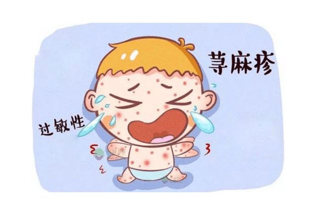 慢性荨麻疹 (3).jpeg