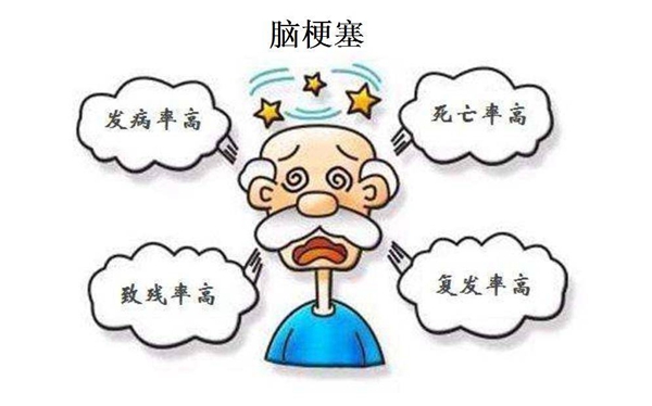 脑梗塞 (6).jpeg