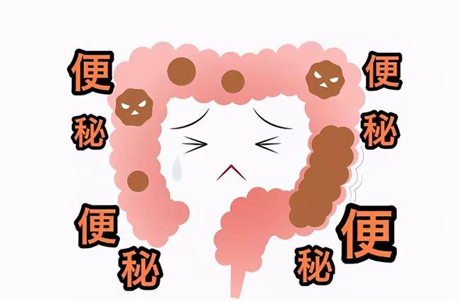 便秘 (1).jpeg