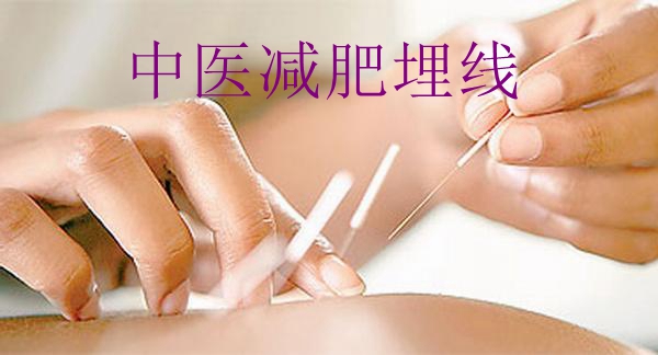 减肥埋线.jpeg
