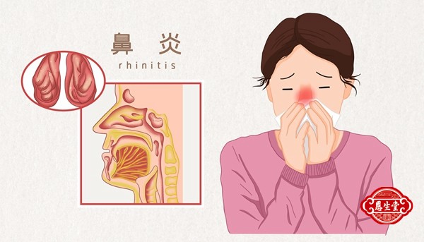 鼻炎.jpg