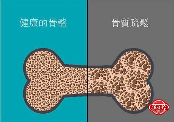 骨质疏松 (5)11.jpg