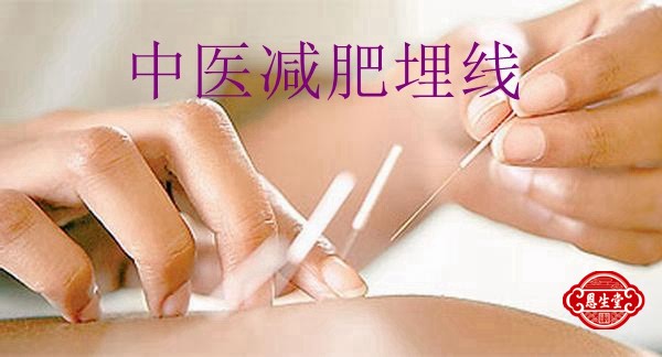 减肥埋线.jpg