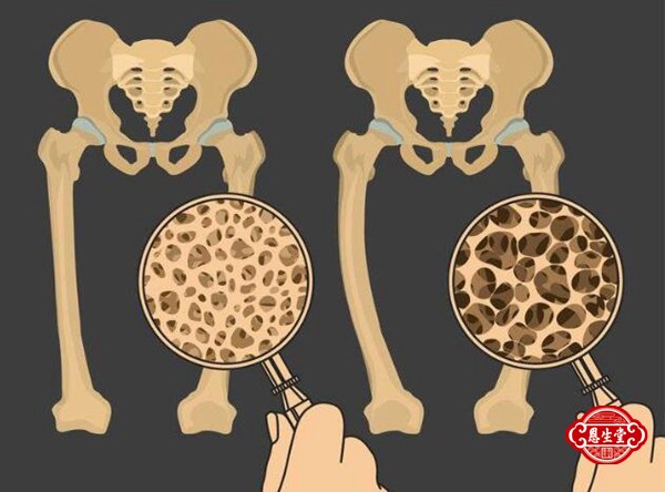 1708932451197251.jpg 骨质疏松 (8)14.jpg