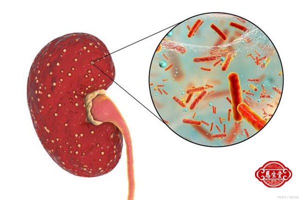 1709014085150979.jpg 红斑狼疮肾炎02.jpg