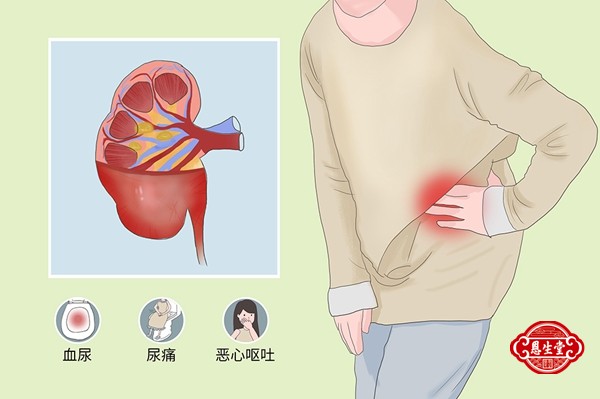 1709024583152365.jpg 肾炎16.jpg