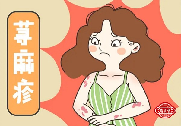 1709102197262985.jpg 荨麻疹 (1).jpg