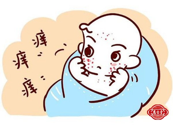 湿疹 (13)09.jpg