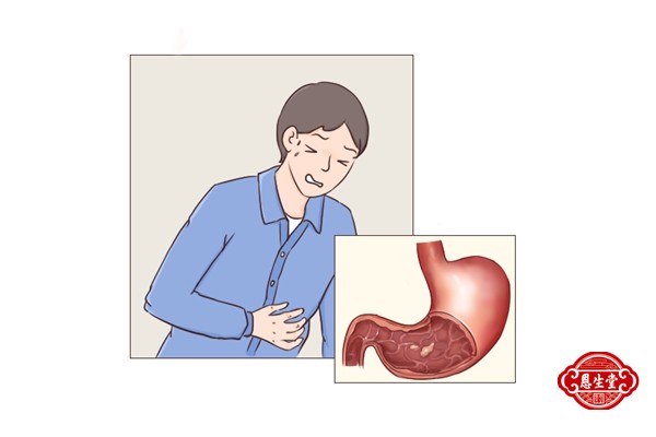 胃溃疡 (1)03.jpg