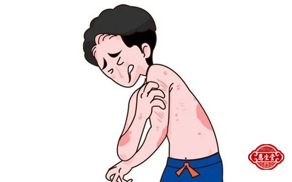 牛皮藓21.jpg