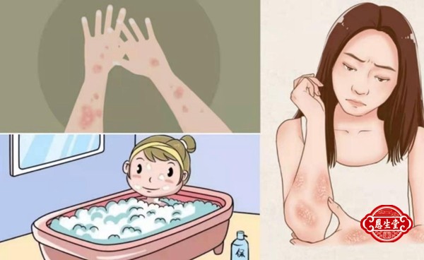 牛皮藓 (9)20.jpg