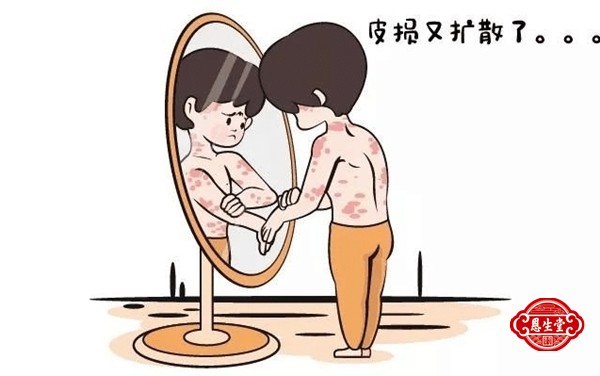 牛皮藓 (8)18.jpg