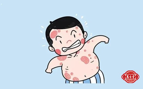 牛皮藓 (6)14.jpg