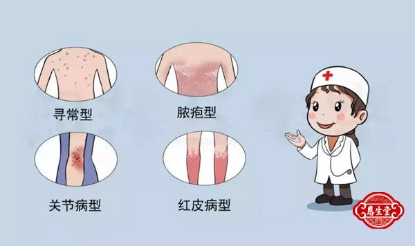 牛皮藓 (5)12.jpg