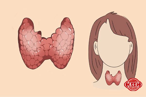 甲状腺 (1).jpg