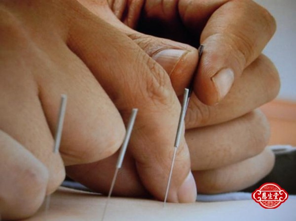 针灸推拿 (1).jpg