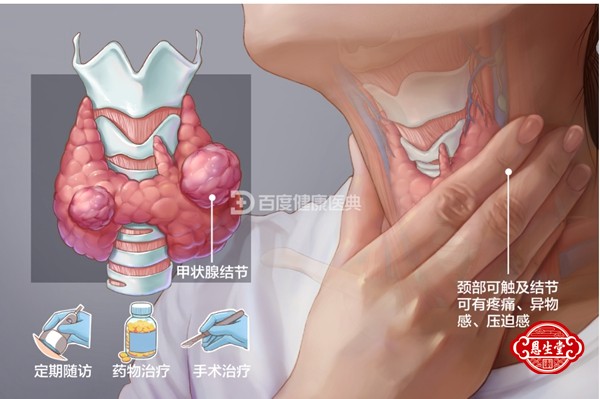 甲状腺 (5)24.jpg