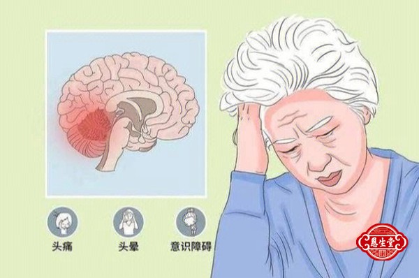 脑萎缩 (1)01.jpg