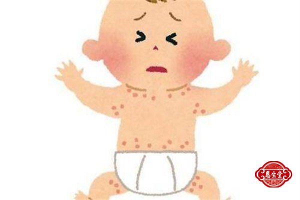 湿疹 (1)02.jpg