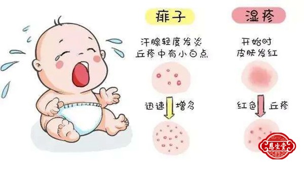 湿疹 (7)22.jpg