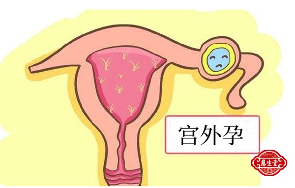 宫外孕 (1)01.jpg