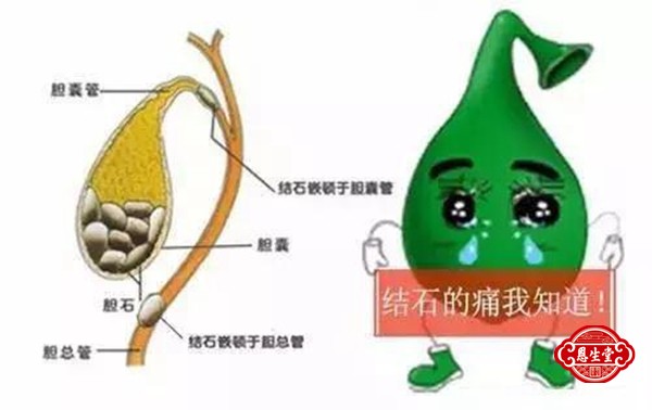 胆囊结石 (10)04.jpg