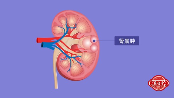 肾囊肿 (4)09.jpg