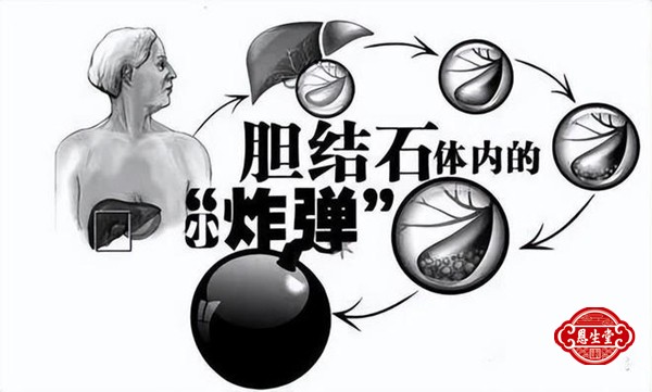 胆囊炎 (8)22.jpg