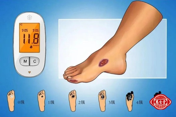 糖尿病26.jpg