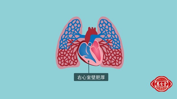 肺心病 (1)02.jpg