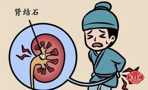 肾结石 (7)13.jpg