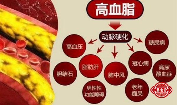 高血脂 (5)20.jpg