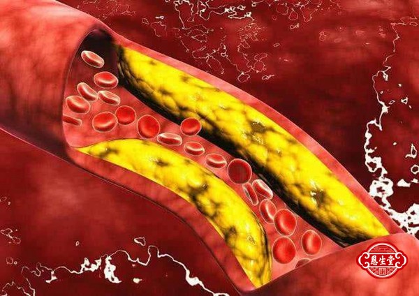 1719889992213850.jpg 高血脂 (7)22.jpg