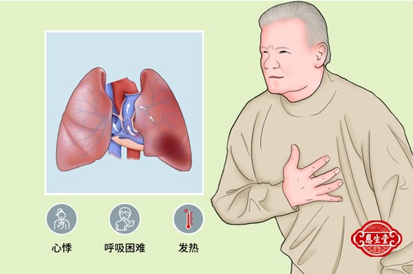 肺心病16.jpg