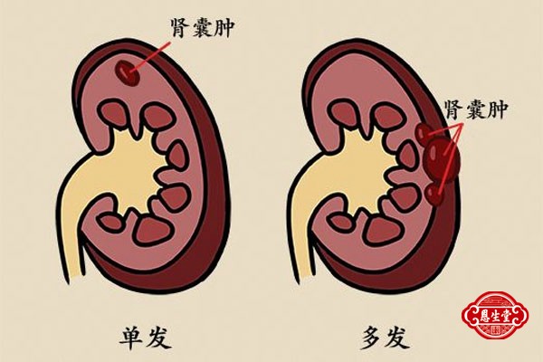 肾囊肿 (2)05.jpg