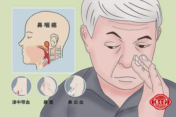 鼻咽癌 (2)07.jpg