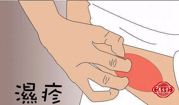 湿疹 (7)23.jpg