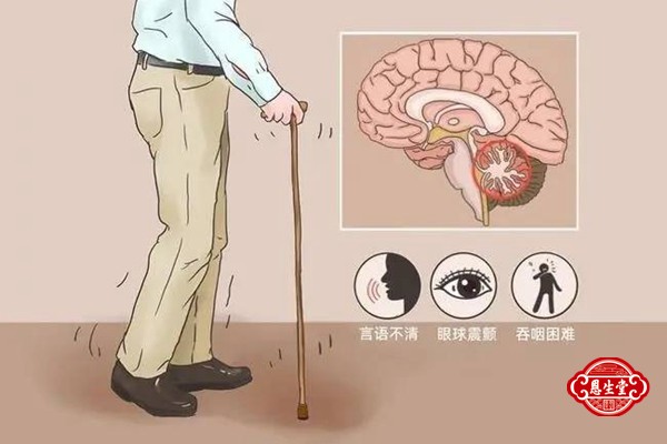 脑萎缩 (5)10.jpg
