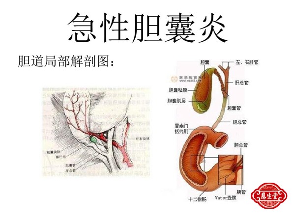 胆囊炎26.jpg