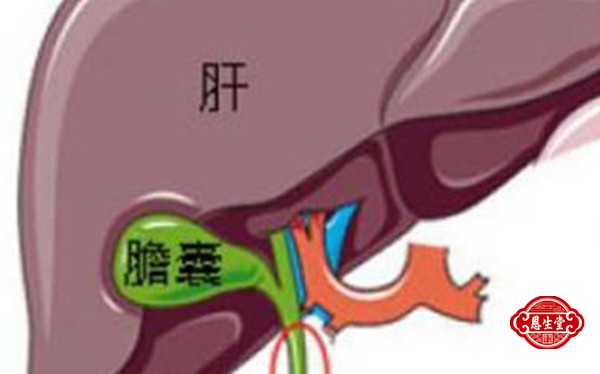 胆囊炎24.jpg