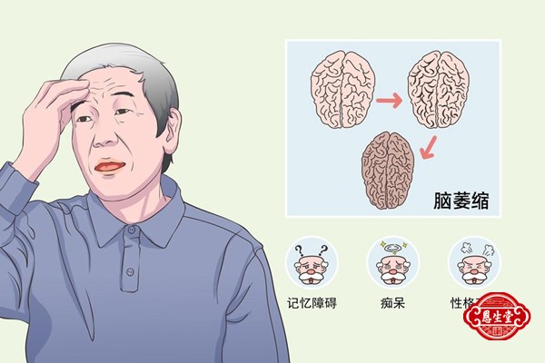 脑萎缩 (2)04.jpg